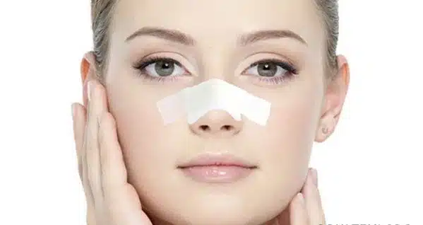 هزینه جراحی بینی