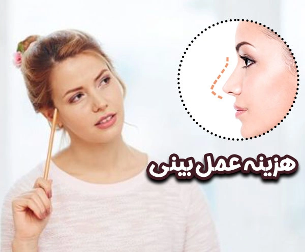 هزینه عمل بینی