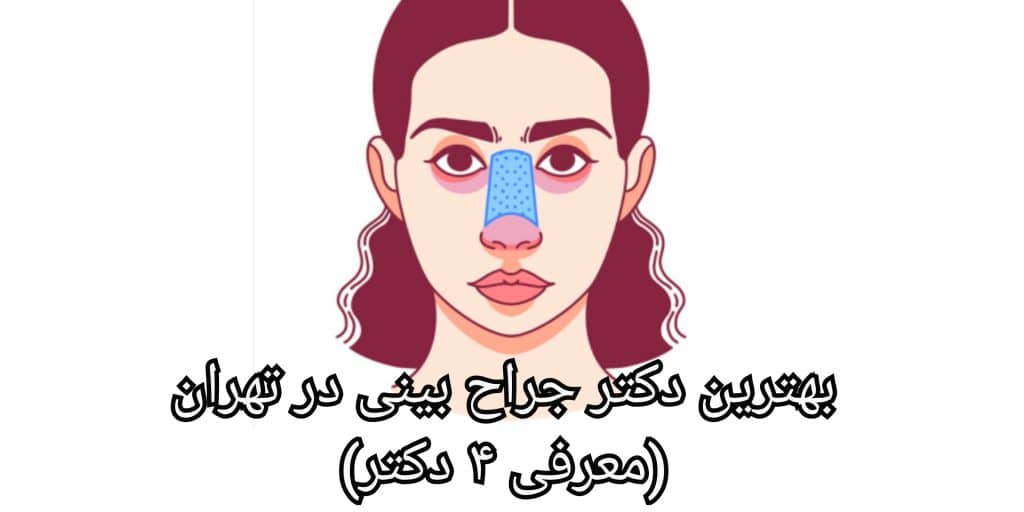 معیارهای انتخاب بهترین دکتر جراح بینی در تهران