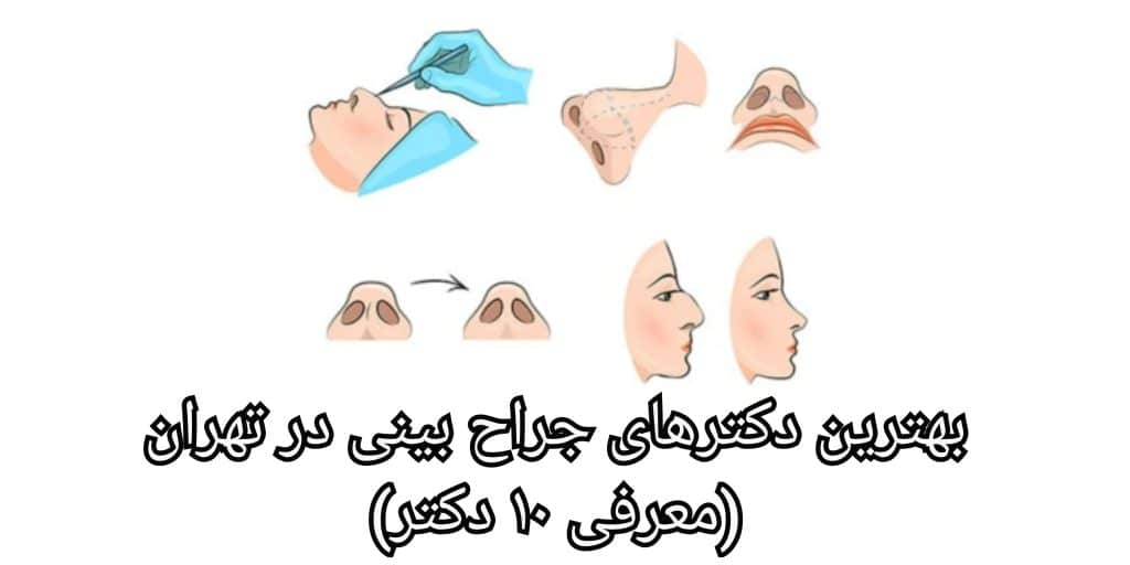 معیارهای بهترین جراح رینوپلاستی در ایران