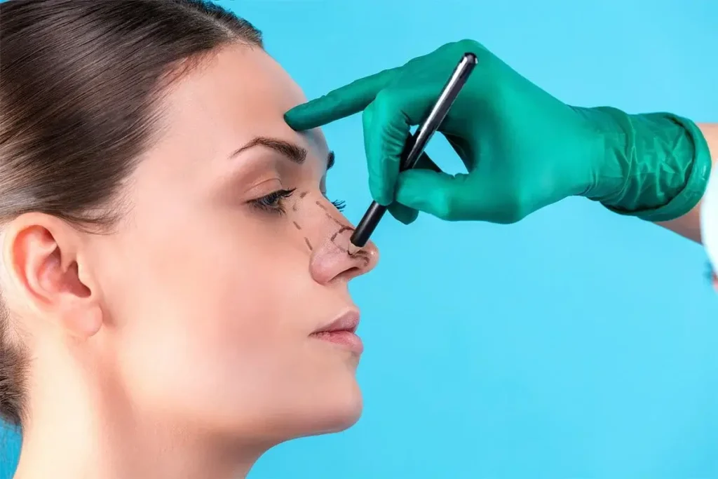 جراحی  بینی به روش  باز و بسته و مشخص کردن نواحی جراحی