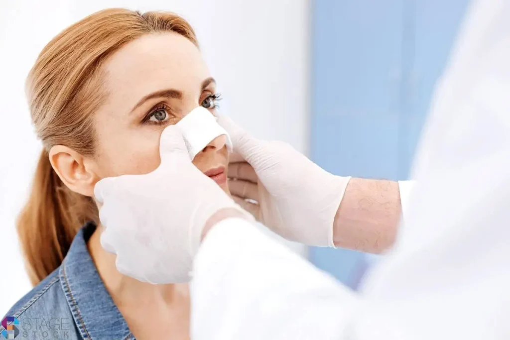 جراحی زیبایی بینی:چسب زدن بینی برای بیمار