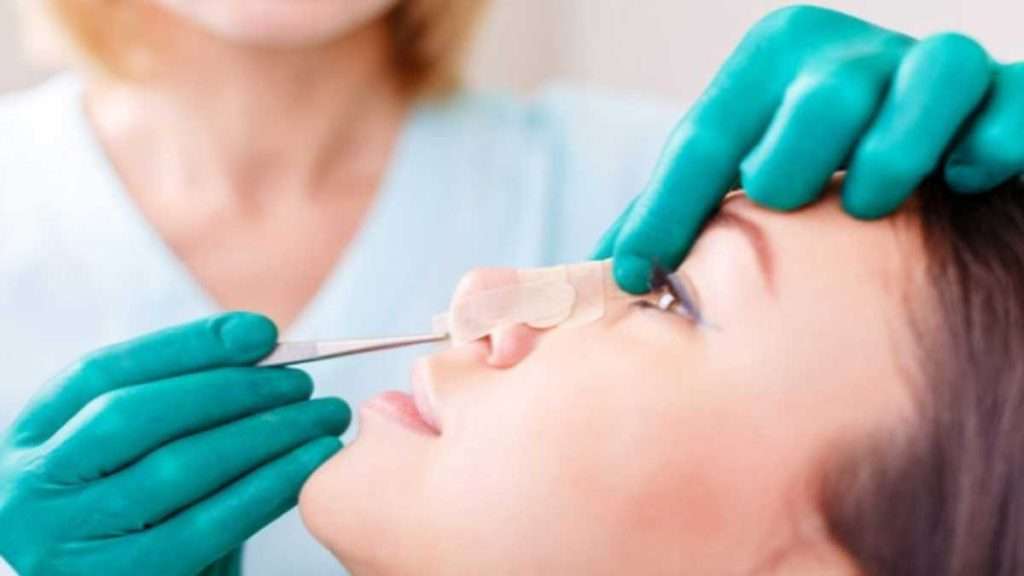 مراقبت های بعد از جراحی بینی مراقبت های بعد از جراحی بینی