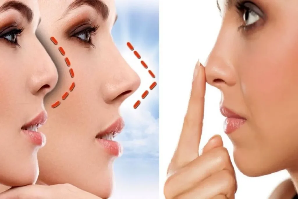 جراحی ترمیمی جراحی ترمیمی بینی