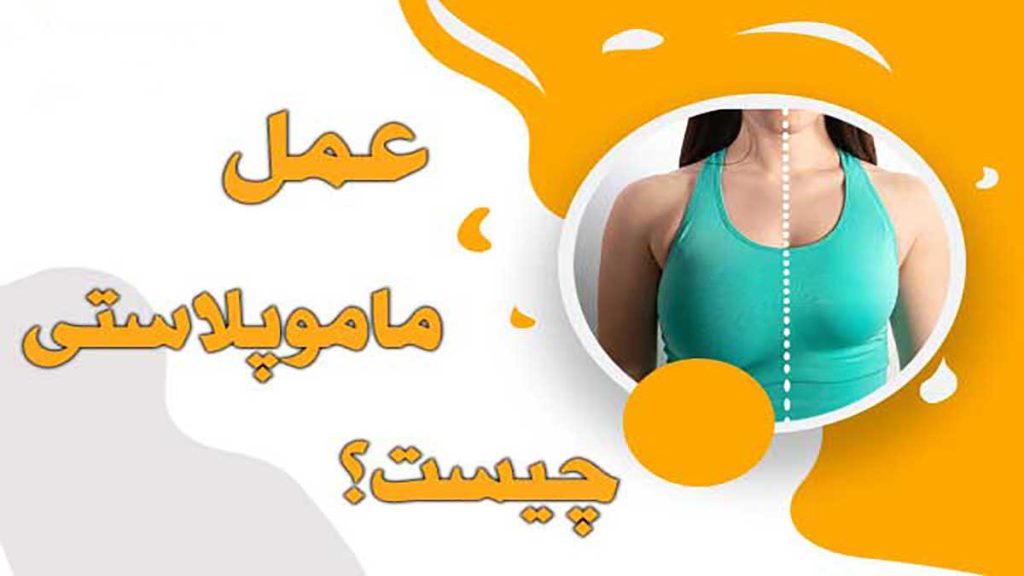قیمت ماموپلاستی هزینه ماموپلاستی با بیمه چقدر است