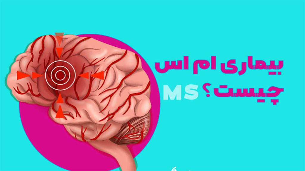 کلینیک تشخیص بیماری ام اس بهترین مرکز تشخیص بیماری ام اس