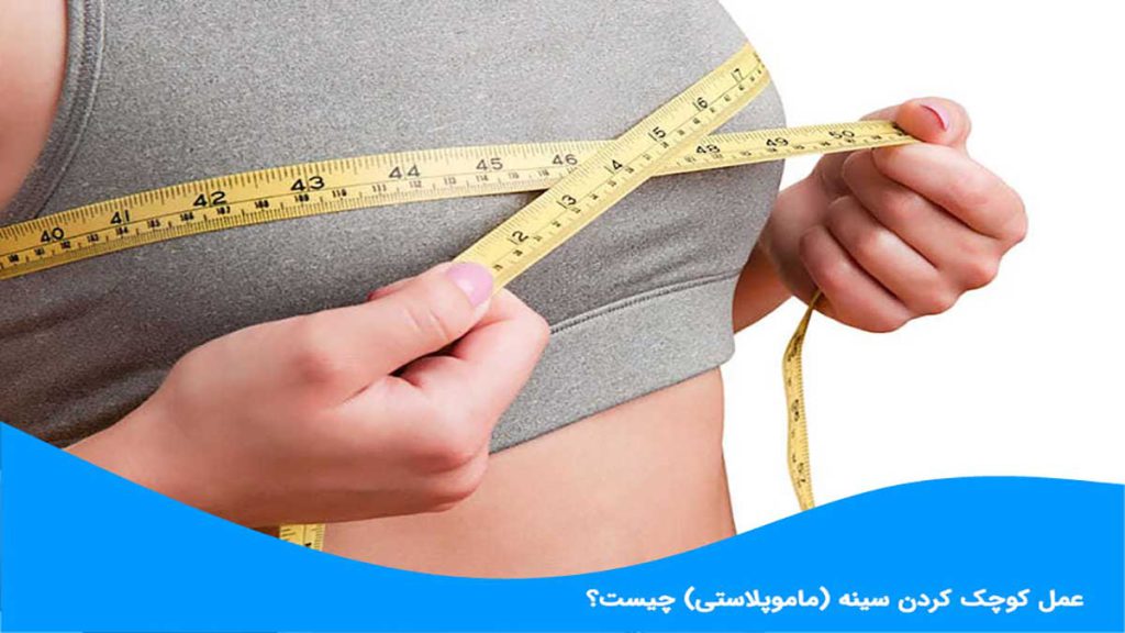 هزینه ماموپلاستی چقدر است